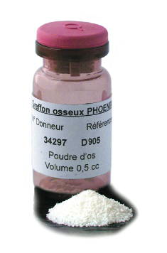 PHOENIX Cancellous bone powder